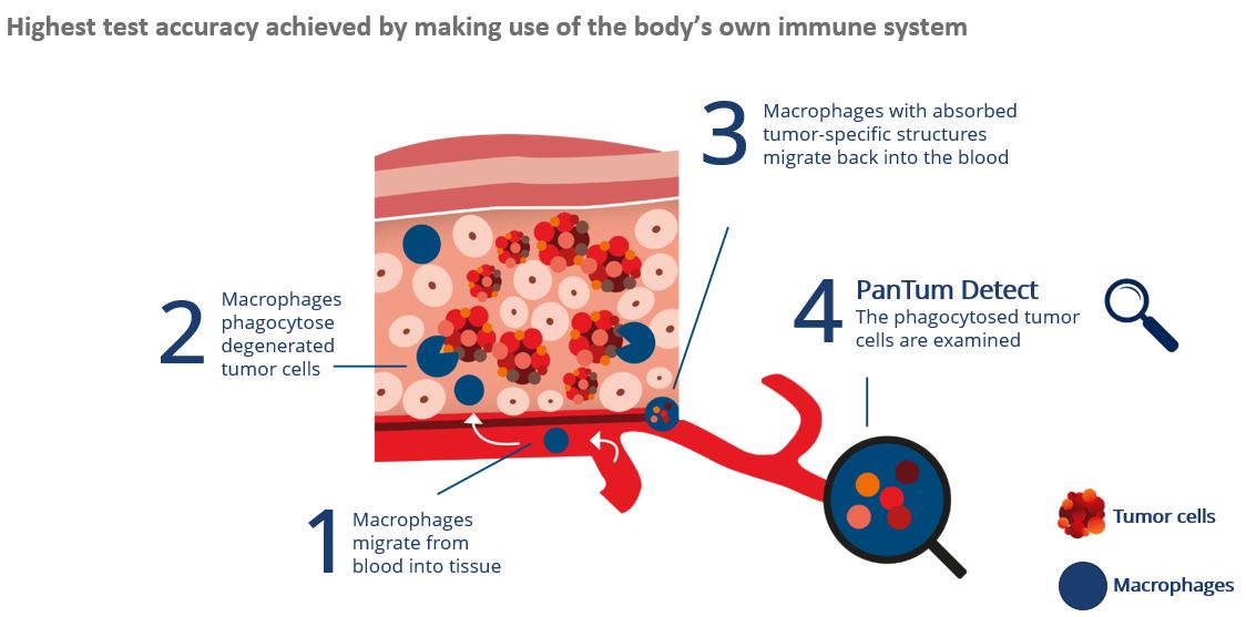 infographic explaining how tumorous cells are examined by PanTum Detect