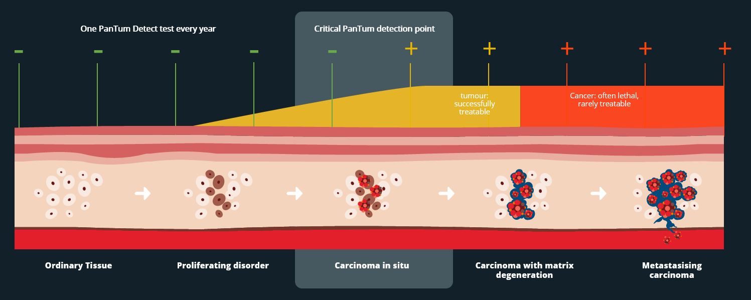 critical cancer detection point - how ordinary tissue becomes cancerous