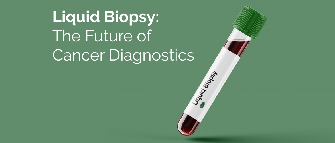 Liquid Biopsy: The Future of Cancer Diagnostics
