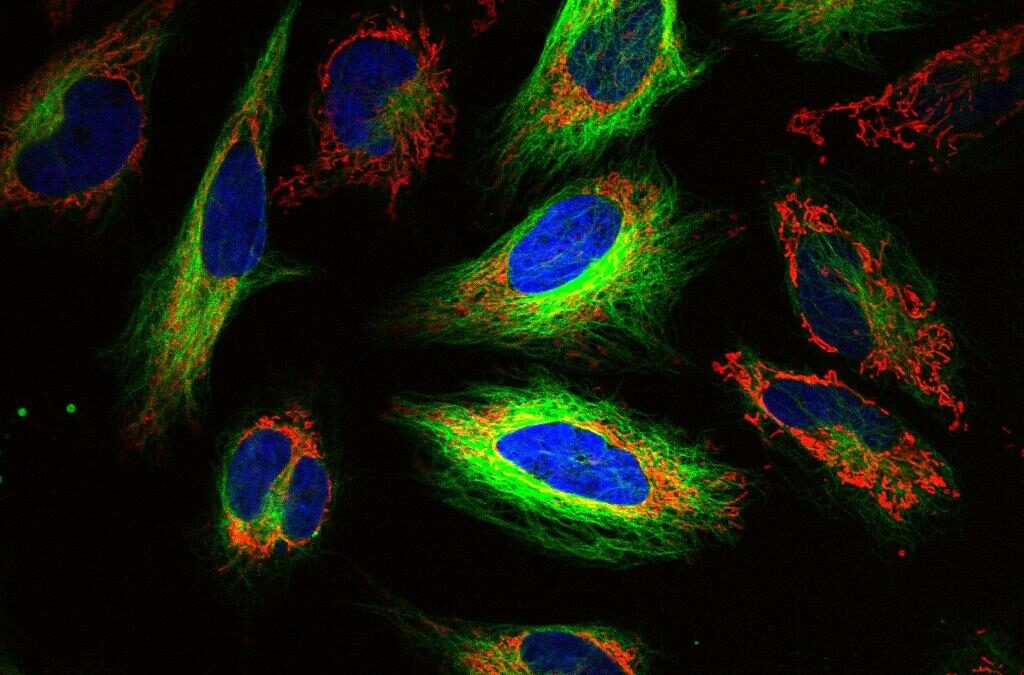 A Mutation Is Not a Destiny: Why the Future of Cancer Detection Lies in Metabolism