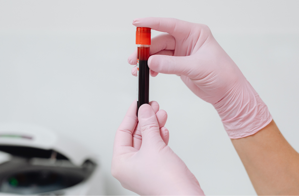 How Could We Detect Cancer Earlier? The Science Behind Liquid Biopsy